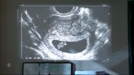 The first baby of Beyond the Gates made its début as a motivational speaker's assistant | Image: CBS
